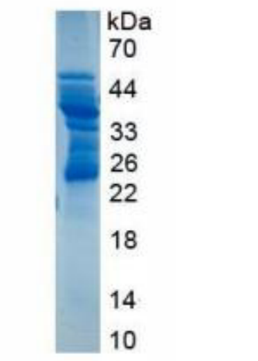 Recombinant Cluster Of Differentiation 83 (CD83),Recombinant Cluster Of Differentiation 83 (CD83)