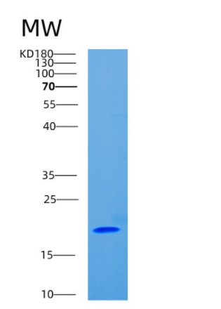 Recombinant Cluster Of Differentiation 8b (CD8b),Recombinant Cluster Of Differentiation 8b (CD8b)