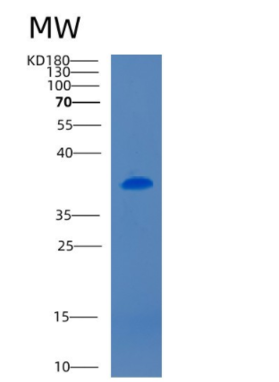 Recombinant Mouse CD5 antigen-like Protein,Recombinant Mouse CD5 antigen-like Protein