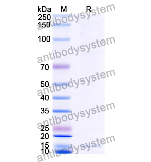 抗 Clostridium botulinum botA/BOTOX 納米抗體 (SAA0929)(RXX00909),Anti-Clostridium botulinum botA/BOTOX Nanobody (SAA0929)