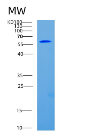 Recombinant Human CD93 Protein,Recombinant Human CD93 Protein