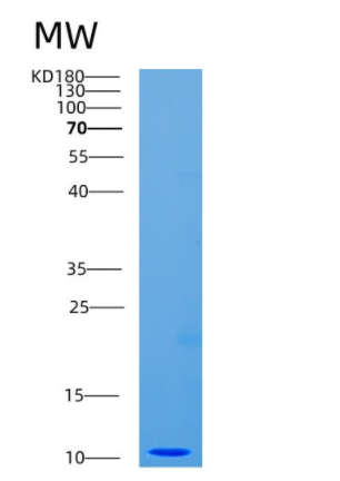 Recombinant Human CDC26 Protein,Recombinant Human CDC26 Protein