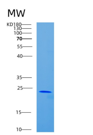 Recombinant Mouse CD80 Protein,Recombinant Mouse CD80 Protein