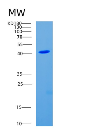 Recombinant Human CDC123 Protein,Recombinant Human CDC123 Protein