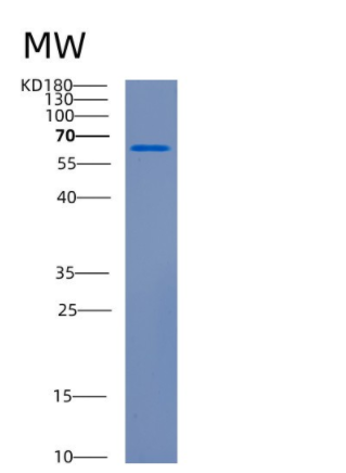 Recombinant Human CDH11 Protein,Recombinant Human CDH11 Protein