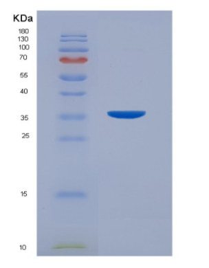 Eukaryotic Cluster Of Differentiation 7 (CD7),Eukaryotic Cluster Of Differentiation 7 (CD7)