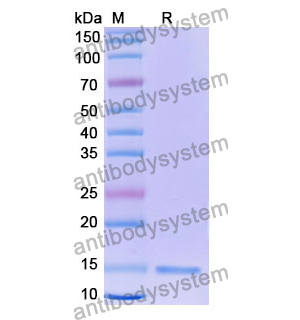 抗 Human IL12B/IL-12 p40/NKSF2 纳米抗体 (SAA1159)(RHD84001),Anti-Human IL12B/IL-12 p40/NKSF2 Nanobody (SAA1159)