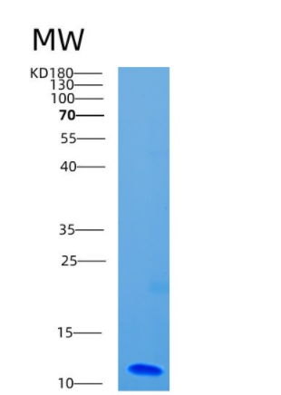 Recombinant Human CD9 Protein,Recombinant Human CD9 Protein