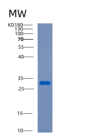 Recombinant Human CDCA8 Protein,Recombinant Human CDCA8 Protein