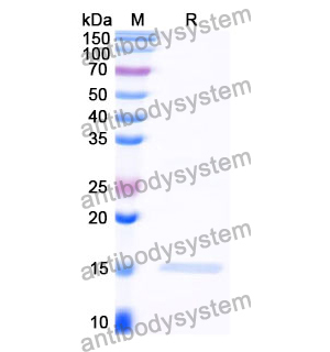 抗 Clostridium botulinum botA/BOTOX 纳米抗体 (SAA0931)(RXX00911),Anti-Clostridium botulinum botA/BOTOX Nanobody (SAA0931)