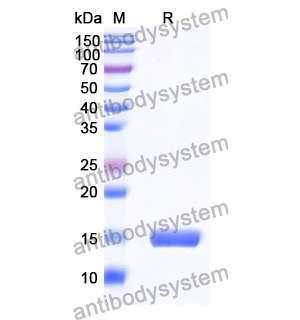 抗 Human EGFR/ERBB1/HER1 納米抗體 (SAA0792)(RHB86901),Anti-Human EGFR/ERBB1/HER1 Nanobody (SAA0792)