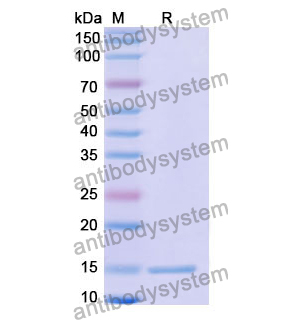 抗 Human CTGF/CCN2 納米抗體 (SAA1211)(RHD82301),Anti-Human CTGF/CCN2 Nanobody (SAA1211)