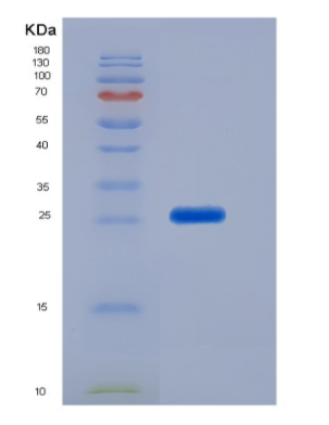 Recombinant Cluster of Differentiation 79B (CD79B),Recombinant Cluster of Differentiation 79B (CD79B)