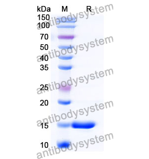 抗 Human SOD1 纳米抗体 (SAA1203)(RHB86001),Anti-Human SOD1 Nanobody (SAA1203)