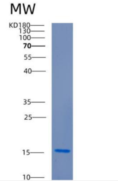 Recombinant Human CDC34 Protein,Recombinant Human CDC34 Protein