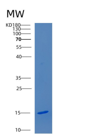 Recombinant Human CDKN2AIPNL Protein,Recombinant Human CDKN2AIPNL Protein