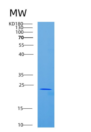 Recombinant Human CD84 Protein,Recombinant Human CD84 Protein