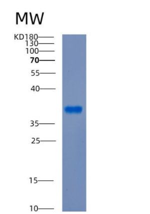 Recombinant Human CDK3 Protein,Recombinant Human CDK3 Protein