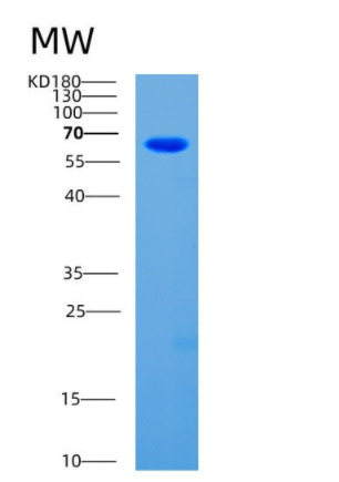 Recombinant Human CDC25A Protein,Recombinant Human CDC25A Protein