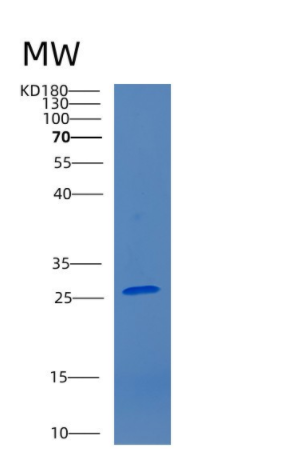 Recombinant Human CDKN3 Protein,Recombinant Human CDKN3 Protein