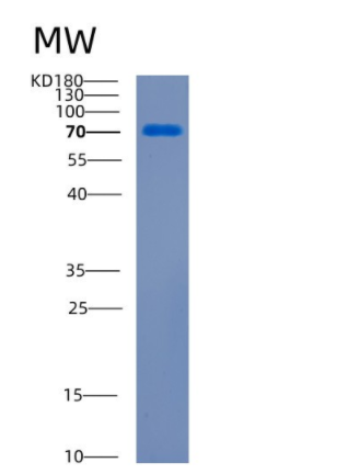 Recombinant Human CDCP1 Protein,Recombinant Human CDCP1 Protein