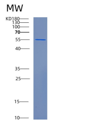 Recombinant Human CFLAR Protein,Recombinant Human CFLAR Protein