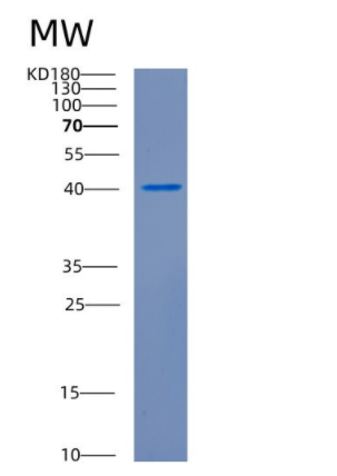 Recombinant Human CDK16 Protein,Recombinant Human CDK16 Protein