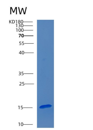 Recombinant Human CEBP-α Protein,Recombinant Human CEBP-α Protein