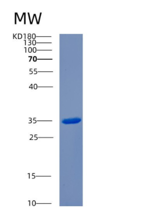 Recombinant Human CENPP Protein,Recombinant Human CENPP Protein