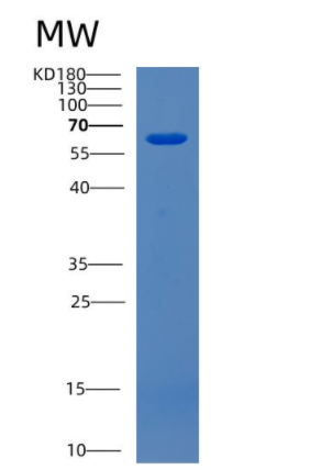 Recombinant Human CDK5RAP3 Protein,Recombinant Human CDK5RAP3 Protein