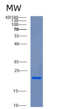 Recombinant Human CETN3 Protein,Recombinant Human CETN3 Protein