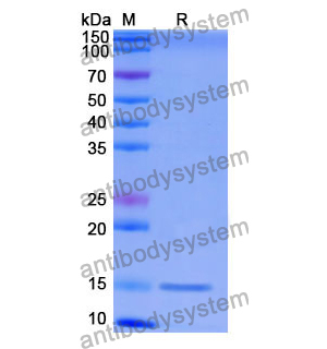 抗 Human CD137/TNFRSF9/4-1BB 納米抗體 (SAA1117)(RHG11001),Anti-Human CD137/TNFRSF9/4-1BB Nanobody (SAA1117)