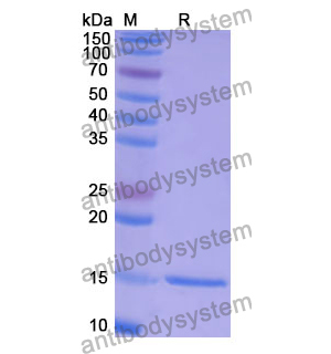 抗 Human CCT5 納米抗體 (SAA1374)(RHE59801),Anti-Human CCT5 Nanobody (SAA1374)