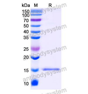 抗 SARS-CoV-2 S Protein 納米抗體 (SAA0989)(RVV00139),Anti-SARS-CoV-2 S Protein Nanobody (SAA0989)