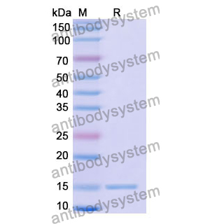 抗 Human HRH2 納米抗體 (SAA0994)(RHD64801),Anti-Human HRH2 Nanobody (SAA0994)