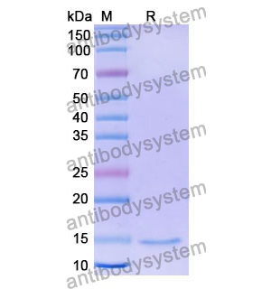 抗 Human MMP12 納米抗體 (SAA1293)(RHE24701),Anti-Human MMP12 Nanobody (SAA1293)