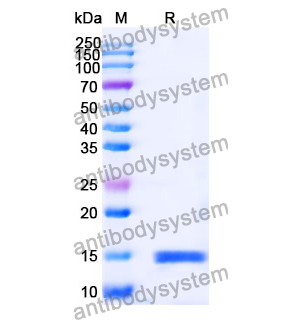 抗 Human Albumin/HSA 纳米抗体 (SAA0807)(RHC01401),Anti-Human Albumin/HSA Nanobody (SAA0807)