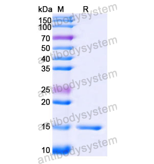 抗 Human ANGPTL4 納米抗體 (SAA1258)(RHJ51401),Anti-Human ANGPTL4 Nanobody (SAA1258)