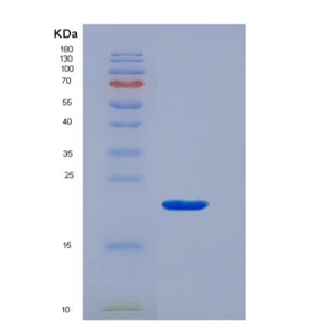 Recombinant T-Cell Surface Glycoprotein CD3 Gamma (CD3g)
