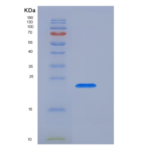 Recombinant T-Cell Surface Glycoprotein CD3 Epsilon (CD3e)