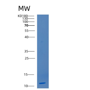 Recombinant Human CD3G Protein,Recombinant Human CD3G Protein