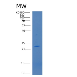 Recombinant Human CD46 Protein
