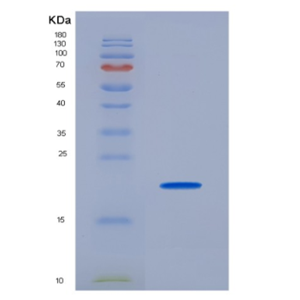 Recombinant Cluster Of Differentiation 74 (CD74)