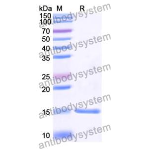 抗 Human CTNNB1 纳米抗体 (SAA1197)(RHE07601),Anti-Human CTNNB1 Nanobody (SAA1197)