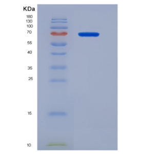 Recombinant Human CD68 Protein,Recombinant Human CD68 Protein