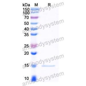 抗 Human CTNNB1 纳米抗体 (SAA1410)(RHE07603),Anti-Human CTNNB1 Nanobody (SAA1410)