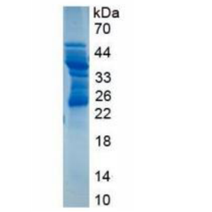 Recombinant Cluster Of Differentiation 83 (CD83)