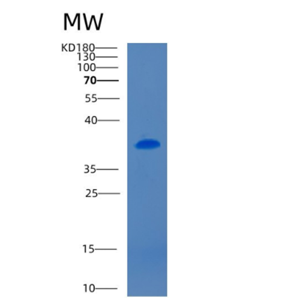 Recombinant Mouse CD5 antigen-like Protein