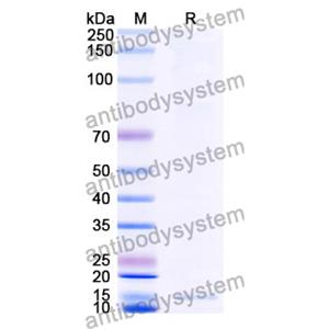 抗 Clostridium botulinum botA/BOTOX 納米抗體 (SAA0929)(RXX00909),Anti-Clostridium botulinum botA/BOTOX Nanobody (SAA0929)