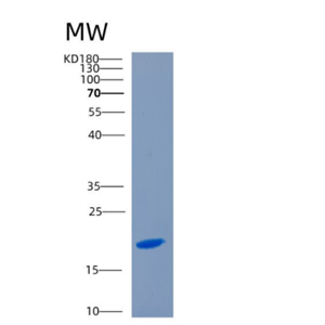 Recombinant Human CD70 Protein